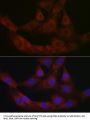 Bone Marrow Proteoglycan (PRG2) Antibody