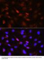 Serine/threonine-Protein Kinase PLK1 (PLK1) Antibody