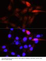 Serine/threonine-Protein Kinase PLK1 (PLK1) Antibody