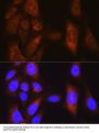Serine/threonine-Protein Kinase PLK1 (PLK1) Antibody
