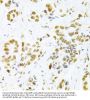 High Mobility Group Protein B1 (HMGB1) Antibody
