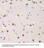 Interferon Regulatory Factor 2 (IRF2) Antibody