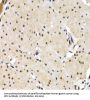Interferon Regulatory Factor 2 (IRF2) Antibody