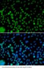 Interferon Regulatory Factor 2 (IRF2) Antibody