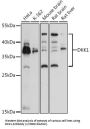 Dickkopf-Related Protein 1 (DKK1) Antibody