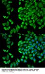 WNK Lysine Deficient Protein Kinase 1 (WNK1) Antibody