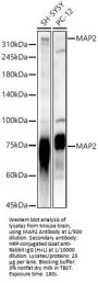 Microtubule Associated Protein 2 (MAP2) Antibody