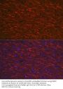 Microtubule Associated Protein 2 (MAP2) Antibody