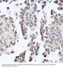 Triosephosphate Isomerase (TPI1) Antibody