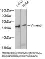 Vimentin (VIM) Antibody