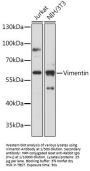 Vimentin (VIM) Antibody