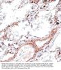 Vimentin (VIM) Antibody
