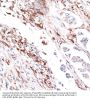 Vimentin (VIM) Antibody