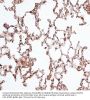 Vimentin (VIM) Antibody