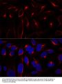 Vimentin (VIM) Antibody