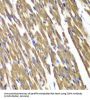 Succinate Dehydrogenase Complex Subunit A (SDHA) Antibody