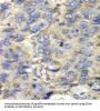 Succinate Dehydrogenase Complex Subunit A (SDHA) Antibody