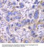 Succinate Dehydrogenase Complex Subunit A (SDHA) Antibody