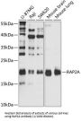 RAP2A, Member of RAS Oncogene Family (RAP2A) Antibody
