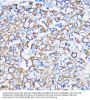 Keratin, Type II Cytoskeletal 5 (KRT5) Antibody