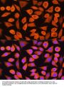 Keratin, Type II Cytoskeletal 5 (KRT5) Antibody
