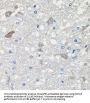 Cadherin Related 23 (CDH23) Antibody