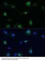 Transitional Endoplasmic Reticulum ATPase (VCP) Antibody