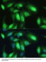 Transitional Endoplasmic Reticulum ATPase (VCP) Antibody