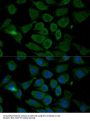 Apoptosis Regulator Bcl-2 (BCL2) Antibody