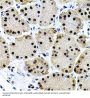 Eukaryotic Translation Initiation Factor 4 Gamma 2 (EIF4G2) Antibody