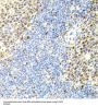 Eukaryotic Translation Initiation Factor 4 Gamma 2 (EIF4G2) Antibody