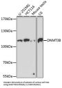 DNA Methyltransferase 3 Beta (DNMT3B) Antibody