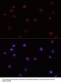 DNA Methyltransferase 3 Beta (DNMT3B) Antibody