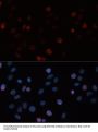 DNA Methyltransferase 3 Beta (DNMT3B) Antibody
