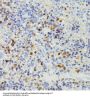 Deoxyuridine Triphosphatase (DUT) Antibody