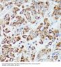 Deoxyuridine Triphosphatase (DUT) Antibody