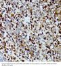 Deoxyuridine Triphosphatase (DUT) Antibody