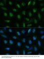 Deoxyuridine Triphosphatase (DUT) Antibody