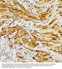 Ectodysplasin-A (EDA) Antibody