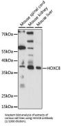 Homeobox Protein Hox-C8 (HOXC8) Antibody