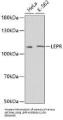 Leptin Receptor (LEPR) Antibody