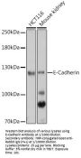 Cadherin-1 / E-Cadherin (CDH1) Antibody