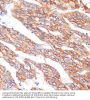 Cadherin-1 / E-Cadherin (CDH1) Antibody
