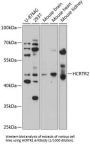 Orexin Receptor Type 2 (HCRTR2) Antibody