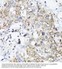 Receptor Activity Modifying Protein 2 (RAMP2) Antibody