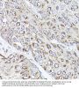 Receptor Activity Modifying Protein 2 (RAMP2) Antibody