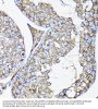 Receptor Activity Modifying Protein 2 (RAMP2) Antibody