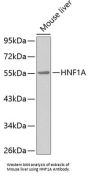 Hepatocyte Nuclear Factor 1 Alpha (HNF1A) Antibody