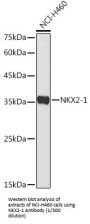 Thyroid Transcription Factor 1 (NKX2-1) Antibody