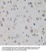 Small Ubiquitin-Related Modifier 3 (SUMO3) Antibody